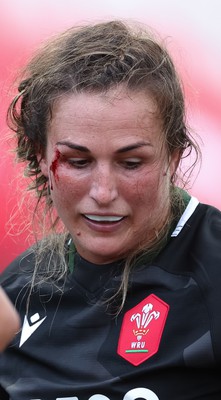 270822 - Canada Women v Wales Women, Summer 15’s World Cup Warm up match - Siwan Lillicrap of Wales receives treatment to an injury