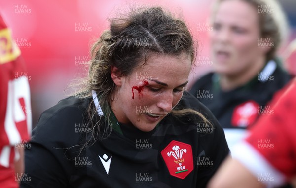 270822 - Canada Women v Wales Women, Summer 15’s World Cup Warm up match - Siwan Lillicrap of Wales receives treatment to an injury