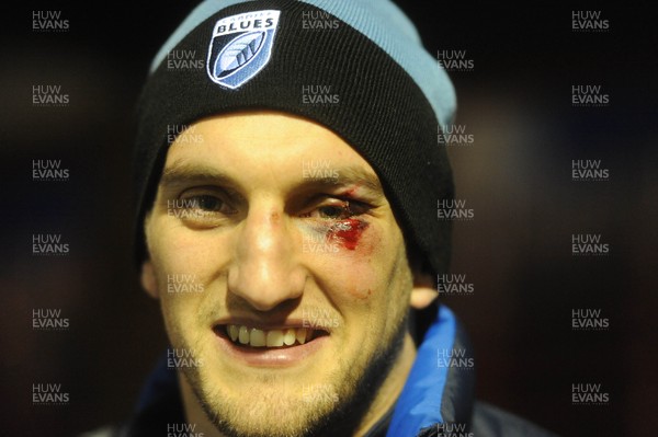 100115 - Cardiff Blues v Leinster - Guinness PRO12 -Sam Warburton of Cardiff Blues shows his eye injury after the game