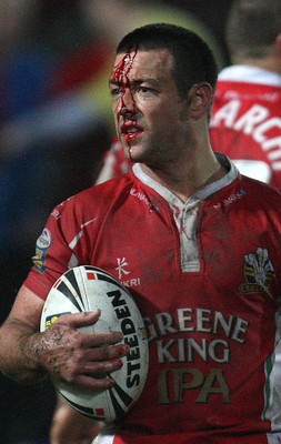 19.03.10 ... Crusaders v Catalans Dragons, engage Super League -  Crusaders' Lincoln Withers shows the scars of battle 