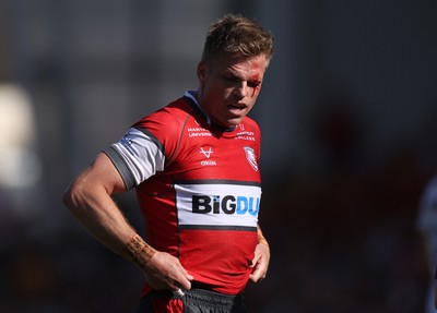270425 - Gloucester Rugby v Exeter Chiefs - Premiership - Gareth Anscombe of Gloucester struggles with a cut to his eye