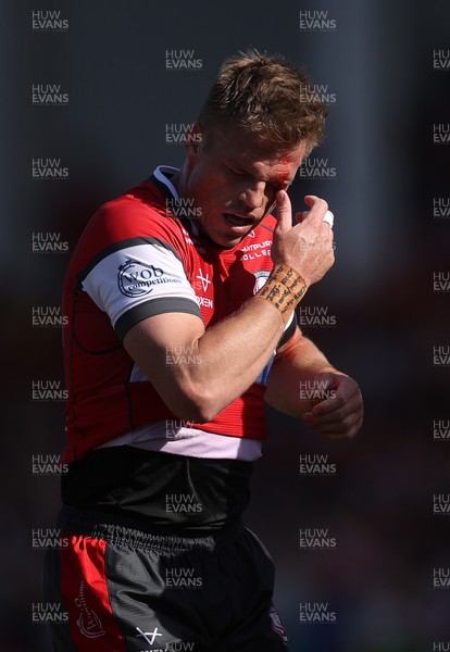 270425 - Gloucester Rugby v Exeter Chiefs - Premiership - Gareth Anscombe of Gloucester struggles with a cut to his eye
