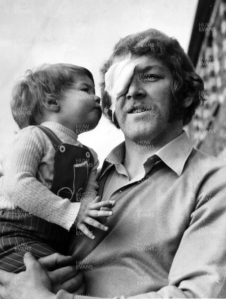 080376 - Picture shows Wales and Pontypool player Graham Price being looked at by daughter Joanne after returning from hospital