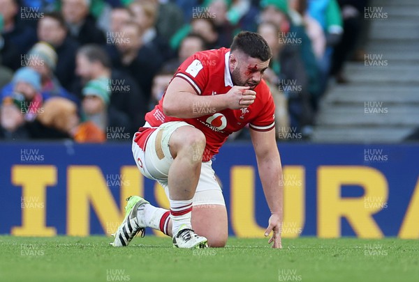 240224 - Ireland v Wales - Guinness 6 Nations Championship - Gareth Thomas of Wales has a blood injury