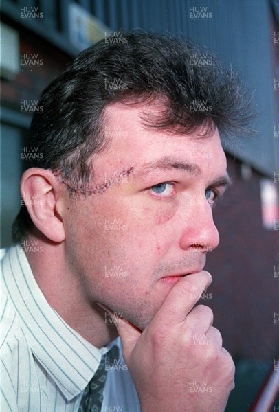 221093 - Picture shows John Parry Jones, son of rugby commentator David with head injuries sustained in a rugby match