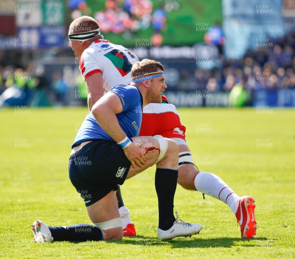 270413 - Leinster v Biarritz - Amlin Challenge Cup - Jamie Heaslip of Leinster sports a cut leg 