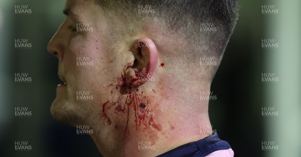 010126 - Ospreys v Cardiff Rugby, United Rugby Championship - Callum Sheedy of Cardiff Rugby with an ear injury
