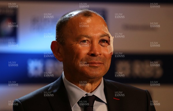 250117 - RBS 6 Nations Launch - England Coach Eddie Jones with his face bandaged up after an incident before the launch