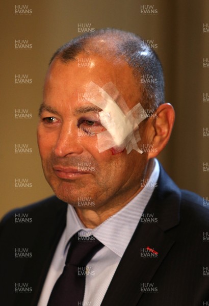 250117 - RBS 6 Nations Launch - England Coach Eddie Jones with his face bandaged up after an incident before the launch