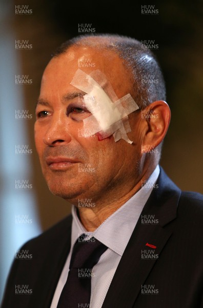 250117 - RBS 6 Nations Launch - England Coach Eddie Jones with his face bandaged up after an incident before the launch