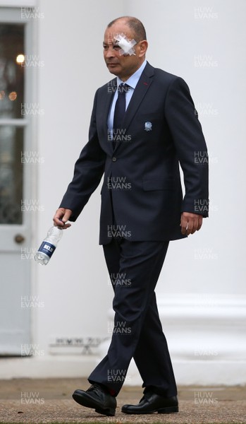 250117 - RBS 6 Nations Launch - England Coach Eddie Jones with his face bandaged up after an incident before the launch