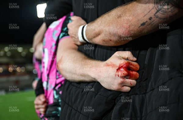 040426 - Ulster v Ospreys - EPCR Challenge Cup Round of 16 - Blood on the hand of Keiran Williams of Ospreys after the match