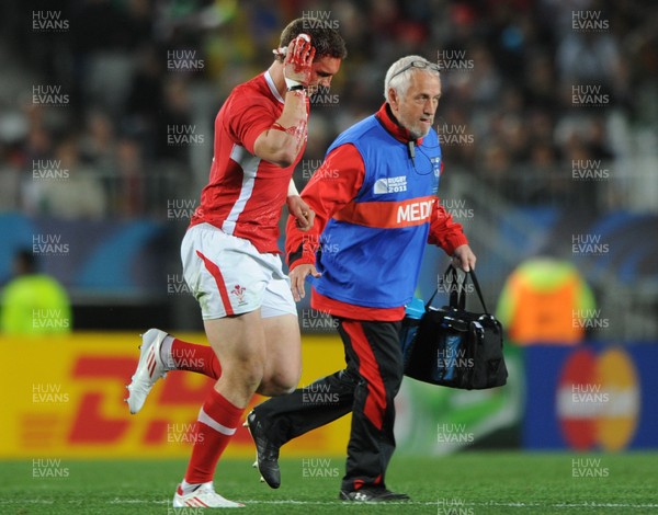 21.10.11 - Wales v Australia - Rugby World Cup Bronze Final - George North of Wales leaves the field with a blood injury. 