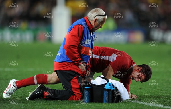 21.10.11 - Wales v Australia - Rugby World Cup Bronze Final - George North of Wales is treated by team doctor Prof John Williams. 