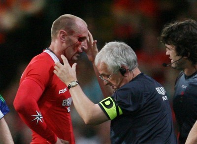 26.08.07  Wales v France... Wales Gareth Thomas receives treatment from the team Doctor 