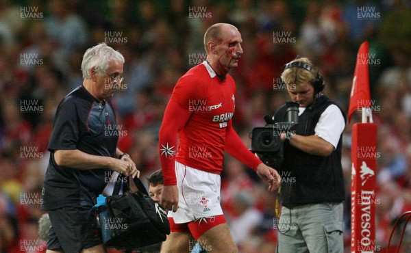 26.08.07  Wales v France... Wales Gareth Thomas receives treatment from the team Doctor 