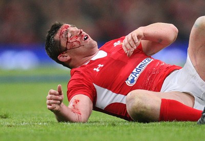 120212 - Wales v Scotland, RBS 6 Nations 2012 -Wales' Huw Bennett is covered in blood after receiving head injury