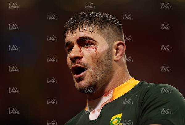 061121 - Wales v South Africa - Autumn Nations Series - Malcolm Marx of South Africa with a deep cut above his eye