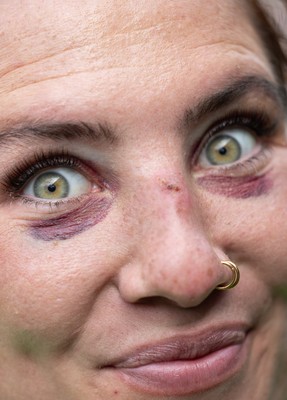 250926 Wales Women Captain’s Run - Georgia Evans, who will win her 50th cap, shows the bruising of a training pitch collision during Captains Run at Cardiff Arms Park ahead of the WXV match against the USA